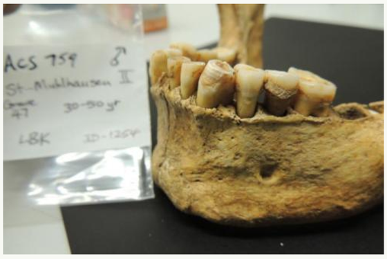 牙菌斑记录人类健康进化史