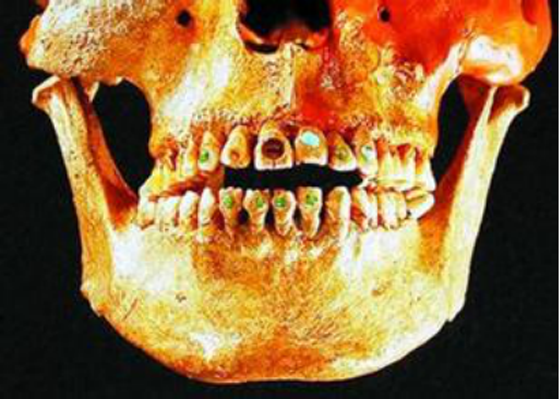 古印第安人曾流行在牙齿上镶嵌宝石
