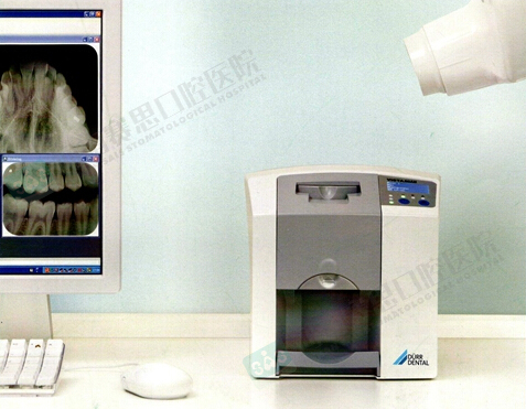 赛思引进德国VistaScan Mini Plus影像板扫描仪