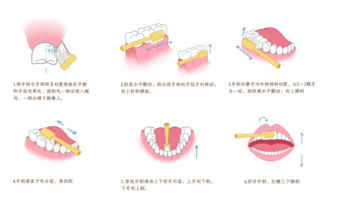 “蛀牙”是如何形成的？如何预防“蛀牙”